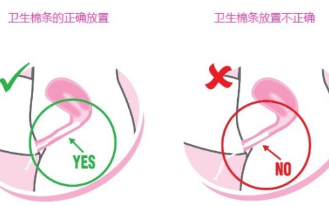 卫生棉条放在什么部位