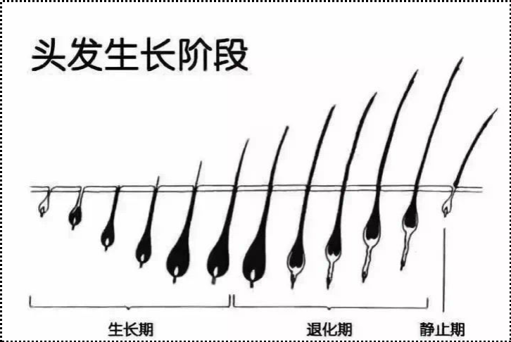 压力大会掉头发吗？原因是什么？