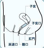 棉条不见了会跑进体内吗