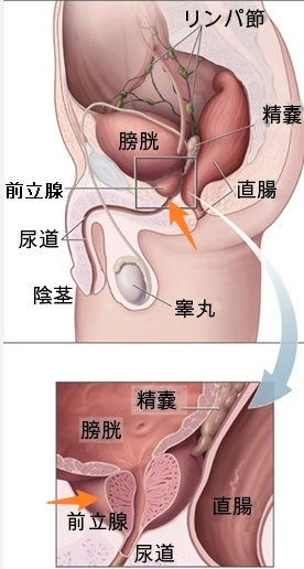 前列腺是什么样子的图片