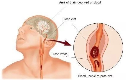 吸草莓真的会把人吸死，3个活生生的案例！