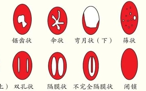 女生的那层膜到底长啥样
