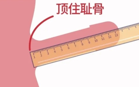 阴痉长度怎么量才是正确的