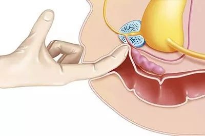 前列腺高C男人的第二快感