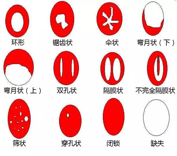 自己把膜不小心弄破了还是处吗