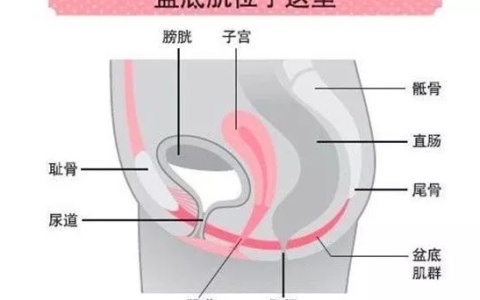 女性盆底肌损伤的危害有哪些
