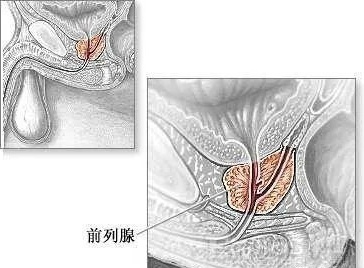 如何获得前列腺高潮状态