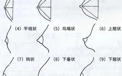 奶型一共分多少种类型