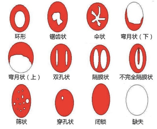 女友明明是处，为什么床单没有血？