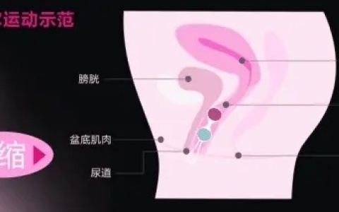 用凯格尔球锻炼是坐着还是躺着好