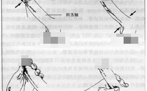 男性丁丁挤捏法手法示意图和正确步骤
