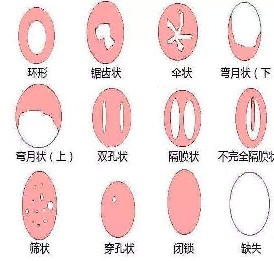 祖传手艺伤身？紫薇次数多了，会发生什么？