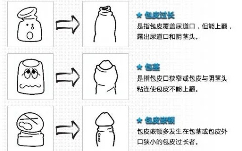 龟头敏感怎么办 4个方法增加龟头敏感度