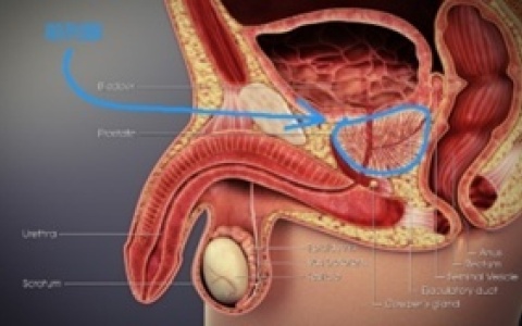 前列腺的那些事儿