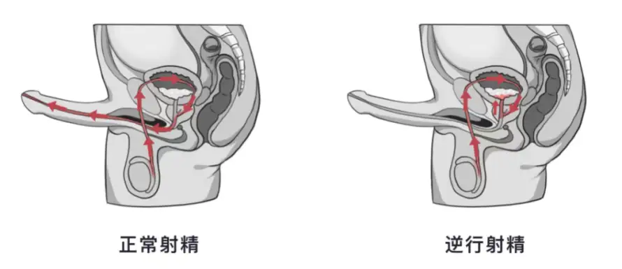 大开眼界：男性为了“延时”整出了多少花样？-62网赚