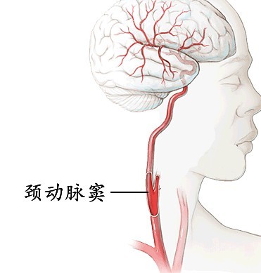 种草莓（吻痕）可以在双腿之间吗-01