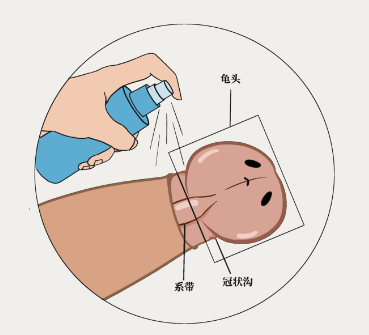 印度神油涂抹在哪个位置